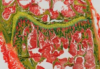 Extracellular matrix biophysical properties play an important role in disease and regeneration. The goal of our Emmy Noether research group, supported by the German Research Foundation (DFG), is to contribute to the understanding of how biophysical mechanisms regulate cell-matrix interaction in cancer dormancy and bone metastasis.