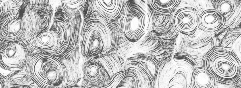 second-harmonic image of collagen fibers around human osteons in a cross-section of the femur.