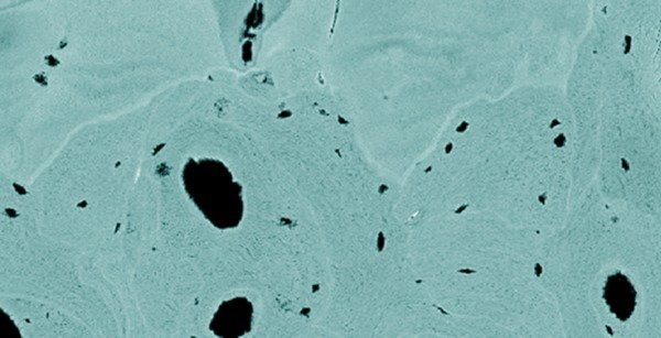 Mineralized Tissues Mineralized Tissues
