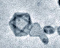 Hohle organische Kapsel mit äußerer Silikatschicht und einem Durchmesser von zwei Mikrometer (Optische Fotografie)