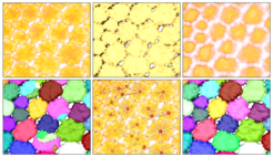 Segmentation workflow (from left to right and top to bottom): Volume rendering of original data; surface of binary segmentation; volume rendering of distance field; initial segmentation using distance field; graph representation; final segmentation.