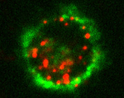 Internalized nanoparticles (red) in a Langerhans cell (green membrane marker). Specific targeting of these skin immune cells may lead to novel approaches for skin vaccination