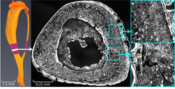 Mäuseknochen: Knochenschnitt unter Laser-Scanning-Mikroskop - vergrößerte Abbildung der dichten Netzwerkarchitektur und des Flüssigkeitsstroms