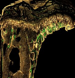 In the figure, bone growth is shown via fluorescent lines (green); method: dynamic histomorphometry