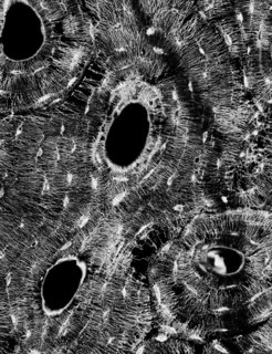 Schwarzweißbild mit ovalen dunklen Flächen die von einem hellen Gespinst aus sehr feinen Kanälen umgeben sind, die radial von den dunklen Punkten weglaufen. Die Kanäle werden in regelmäßigen Abständen von Kanälen geschnitten, die konzentrisch zu den dunklen Flächen verlaufen. An ihnen sind schmale helle Flecken (Lakunen) zu erkennen.