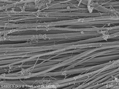Unter dem Elektronenmikroskop: Kollagenfaserbündel nach der Mineralisation mit (dem Knochenmineral) Kalziumphosphat