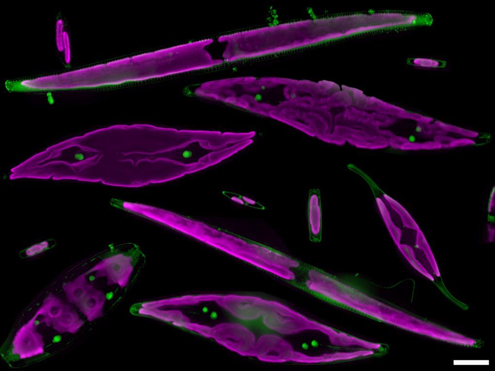 Microscopy image Diatoms