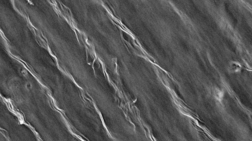 Chia seed mucilage Microscopy image