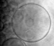vesicle cluster
